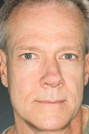 Richard Lineback