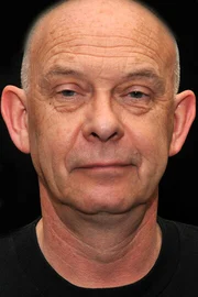 Doug Bradley